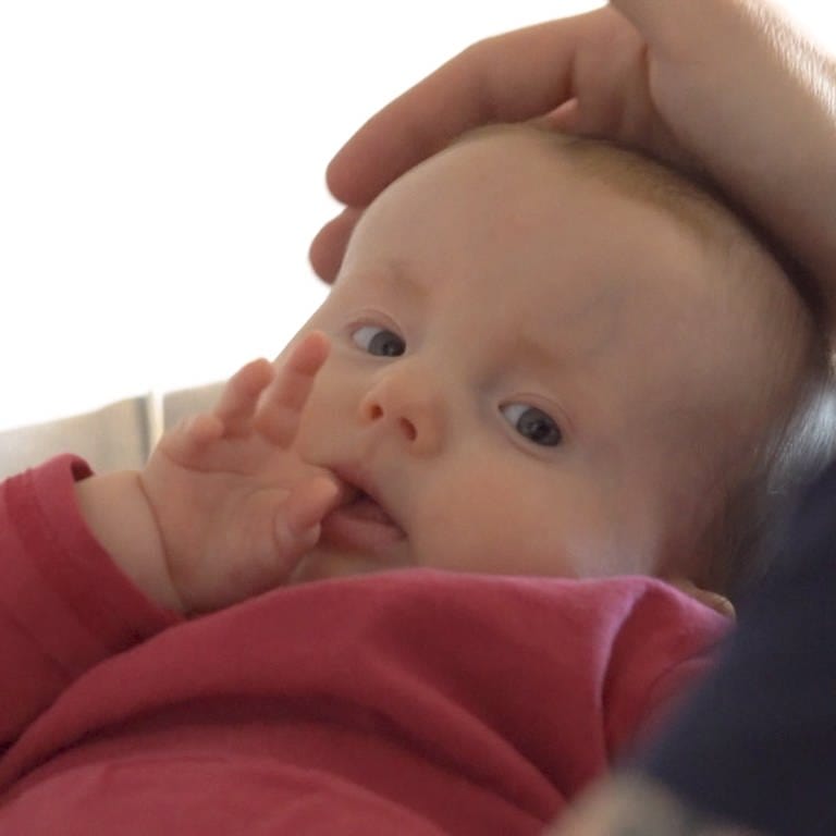 Neugeborenes Baby mit Trisomie 18
