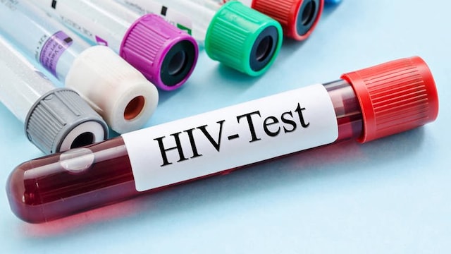 19.5.1987: In Bayern wird ein AIDS-Test für Homosexuelle angeordnet