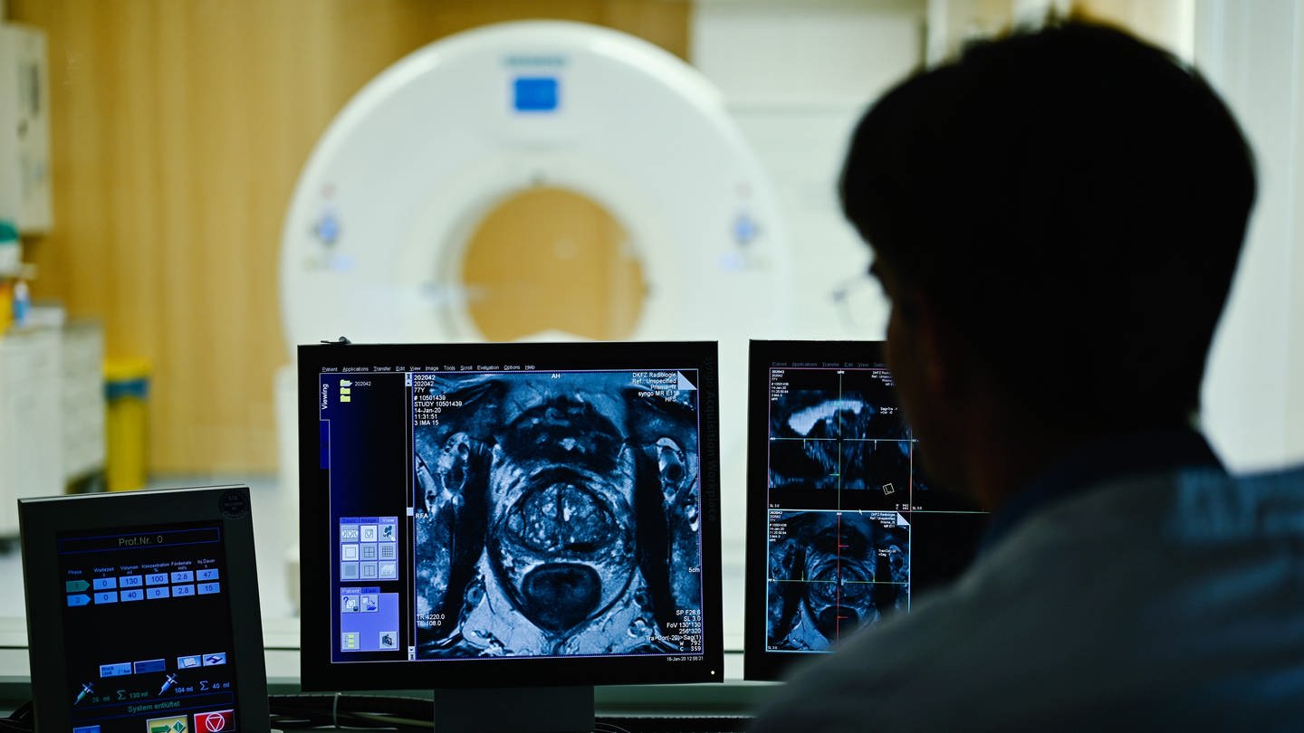 Ein Mitarbeiter betrachtet in einem Kontrollraum des Deutschen Krebsforschungszentrum (DKFZ) auf einem Monitor das Querschnittsbild einer Prostata. Durch die Corona-Pandemie sind nach Angaben des Deutschen Krebsforschungszentrums in Heidelberg weniger Menschen zur Krebsvorsorge gegangen.