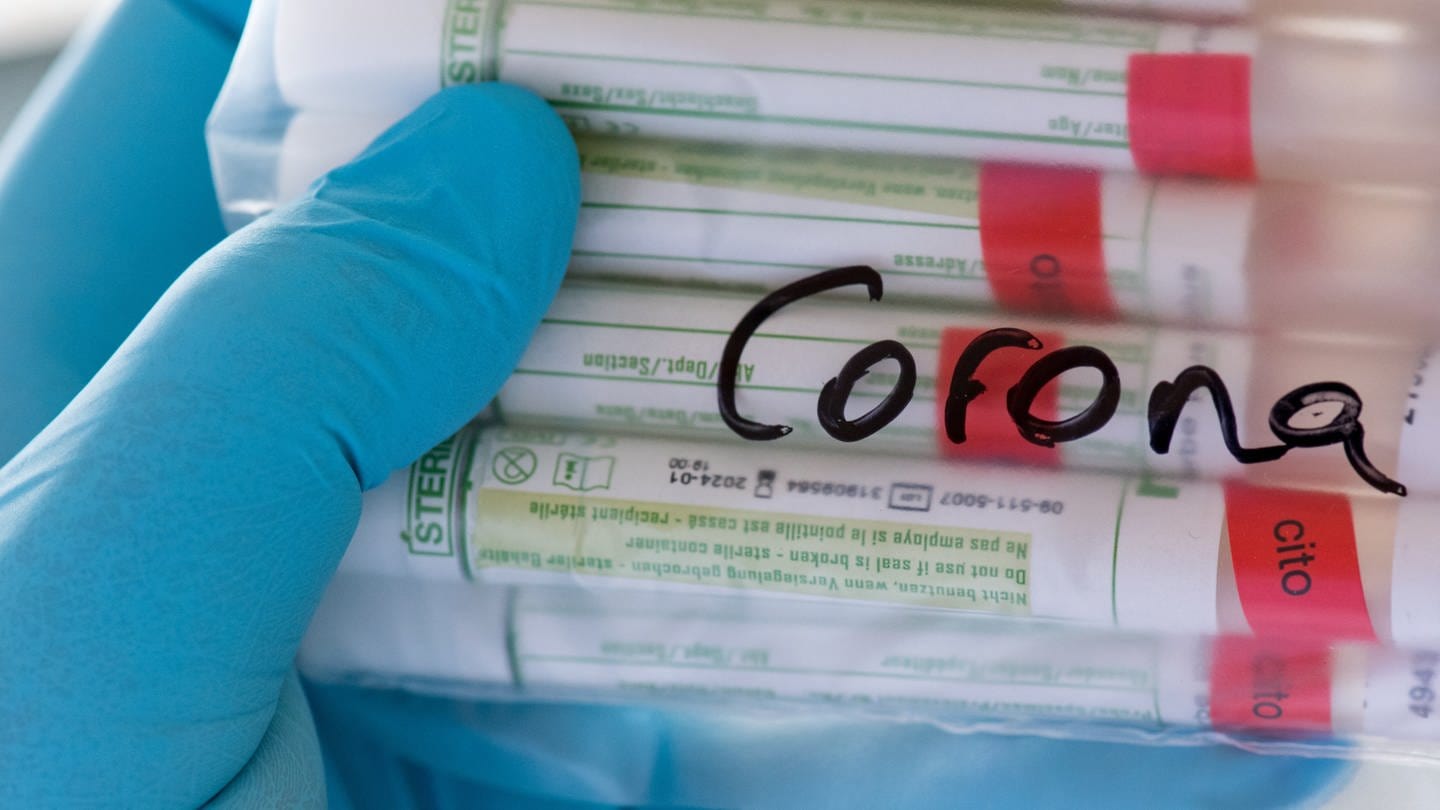 Baden-Württemberg examines all positive corona tests for mutants – SWR Aktuell