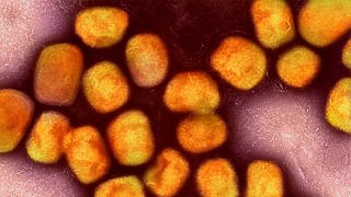 Eine kolorierte elektronenmikroskopische Aufnahme von Partikeln des Affenpockenvirus
