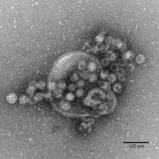 Elektronenmikroskopische Aufnahme von Noroviren (undatierte Aufnahme). (Archivbild)