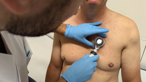 Ein Arzt mit blauen Hygienehandschuhen kontrolliert mit einer Lupe die Muttermale auf dem Körper eines Mannes.
