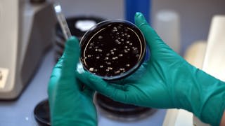 Eine Petrischale mit Legionellen in einem Labor: In mehreren Hochhäusern in Ulm-Wiblingen gibt es wegen der Bakterien aktuell ein Duschverbot (Symbolbild).