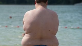 Ein übergewichtiger Junge steht an einem Badesee. Die Arztstudie der Barmer Krankenkasse hat ergeben, dass Kinder immer dicker werden.