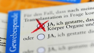 Die Rückseite eines ausgefüllten Organspendeausweises, das Zustimmungsfeld ist angekreuzt. In Ludwigshafen sollen sich auch mehr Muslime als Organspender melden.