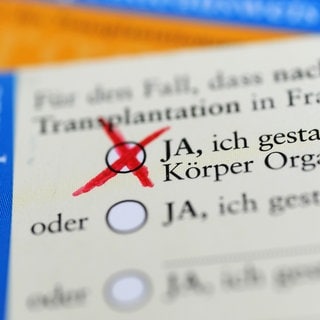 Die Rückseite eines ausgefüllten Organspendeausweises, das Zustimmungsfeld ist angekreuzt. In Ludwigshafen sollen sich auch mehr Muslime als Organspender melden.