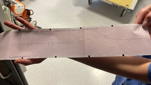 Station 22 - Arbeit auf der Intensivstation des Klinikums Idar-Oberstein - EKG Bild vor und nach einer Kardioversion.