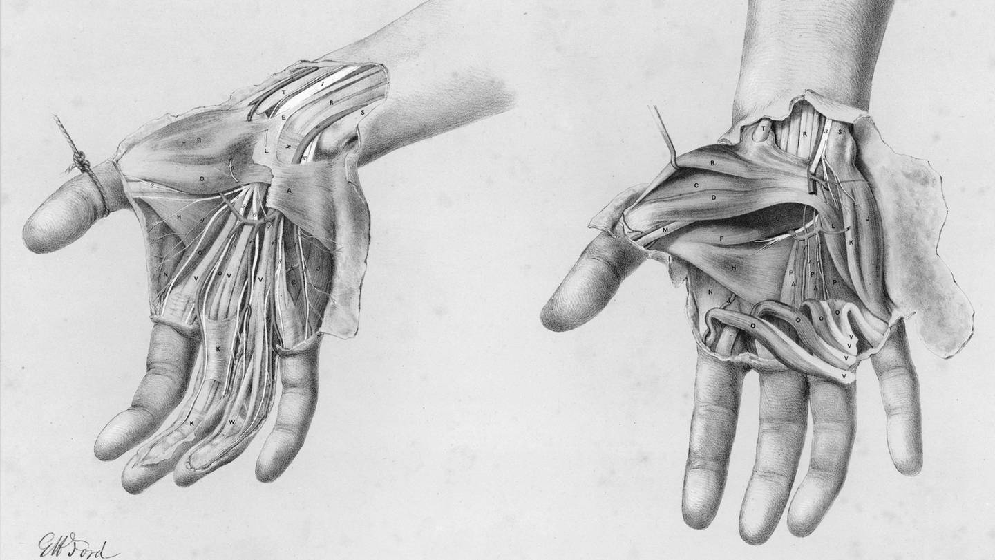 Superficial and deep views of the palm of the hand