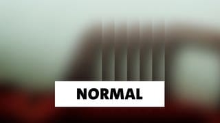 Wort der Woche: Normal