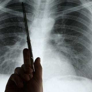 Lungenkrebsdiagnose