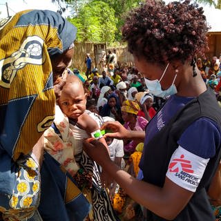 Eine Mitarbeiterin der Hilfsorganisation "Médecins Sans Frontières  Ärzte ohne Grenzen" misst in der Provinz Cabo Delgado in Mosambik den Oberarmumfang eines Kindes um festzustellen, wie gut es ernährt ist.