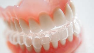 Zahngesundheit ist wichtig: Knirschschiene für den Unterkiefer