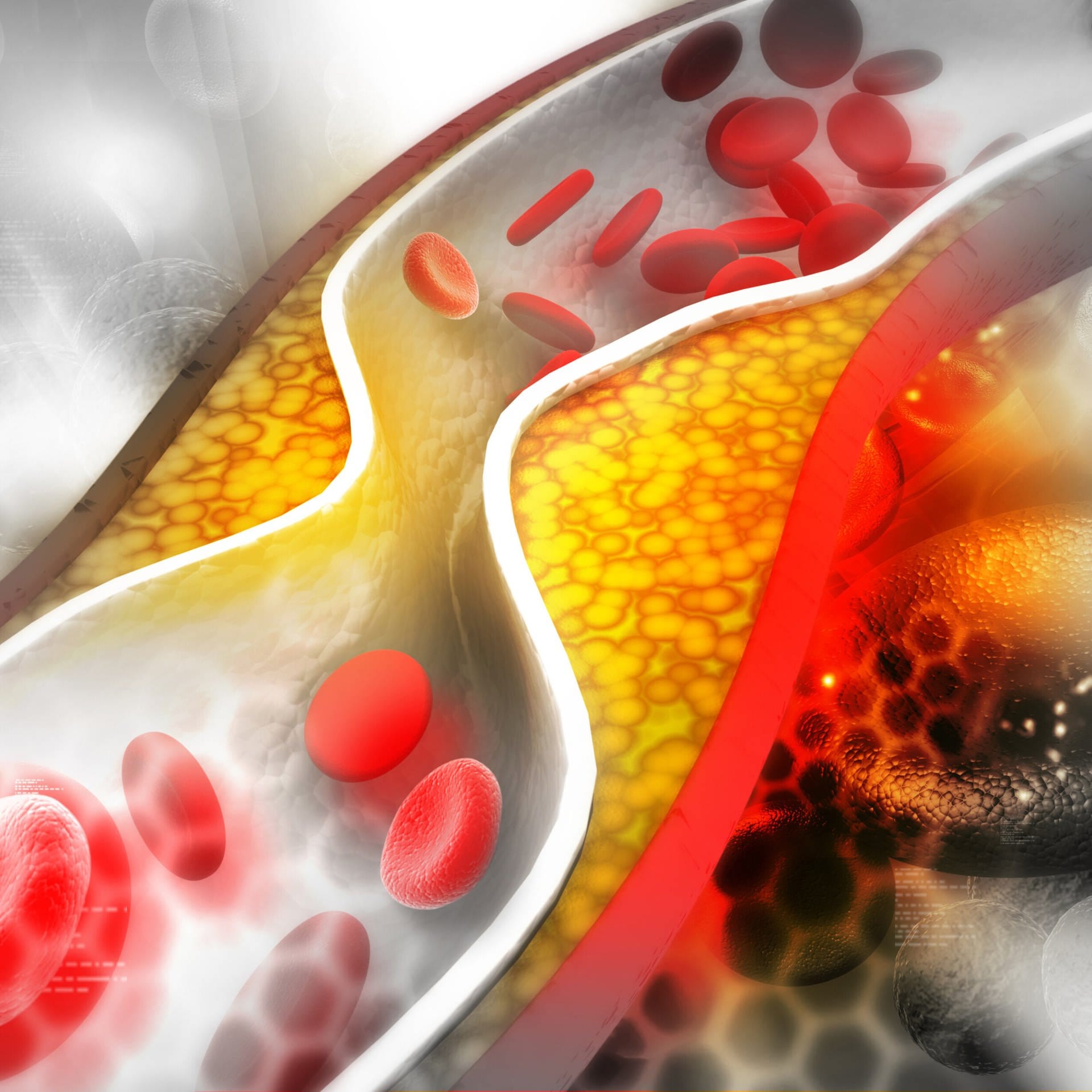 Cholesterin – Was gegen hohe Werte hilft