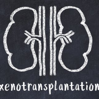 Symbolbild: Kreidezeichnung von Nieren und medizinischer Begriff Xenotransplantation