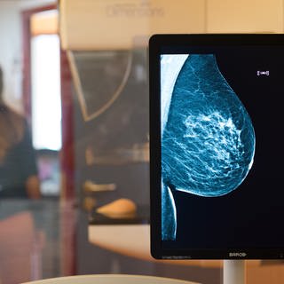 Die gesunde Brust einer Frau ist auf einer Röntgenaufnahme zu sehen.