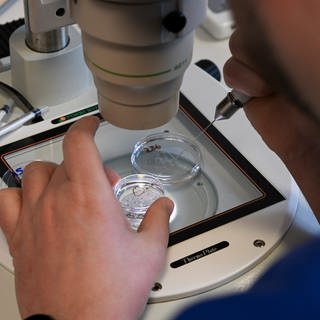 Symbolbild: Im Zelllabor im Fertility Center Berlin wird an einem Elektronenmikroskop die Befruchtung einer Eizelle vorbereitet.