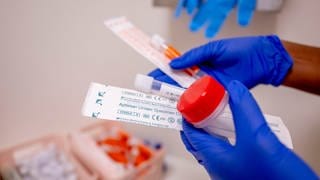 Testkit für Geschlechtskrankheiten: Infektionen durch Sex mit Syphilis- oder Tripper-Bakterien oder Chlamydien werden oft nicht erkannt und unbemerkt weitergegeben, weil sich die wenigsten Menschen regelmäßig testen lassen. Dabei können sie neben Schmerzen Unfruchtbarkeit zur Folge haben – auch bei Männern. 