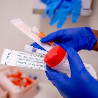 Testkit für Geschlechtskrankheiten: Infektionen durch Sex mit Syphilis- oder Tripper-Bakterien oder Chlamydien werden oft nicht erkannt und unbemerkt weitergegeben, weil sich die wenigsten Menschen regelmäßig testen lassen. Dabei können sie neben Schmerzen Unfruchtbarkeit zur Folge haben – auch bei Männern. 