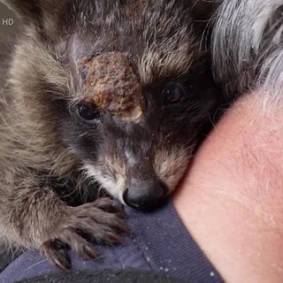 ein verletzter Waschbär kuschelt sich in den Nacken seines Retters