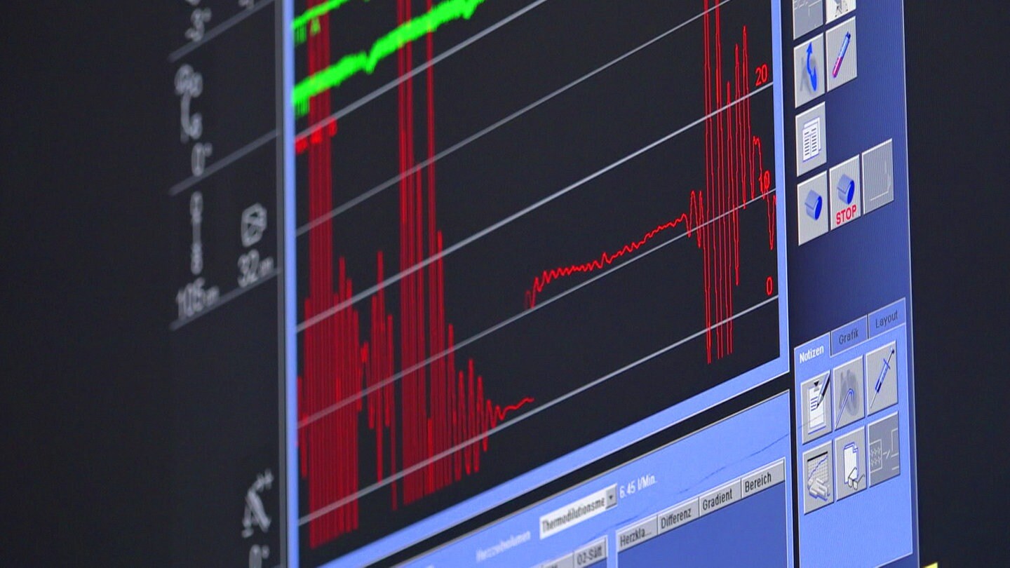 Herzfrequenz auf Überwachungsmonitor sichtbar gemacht