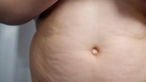 Übergewichtiger Junge zeigt Bauch