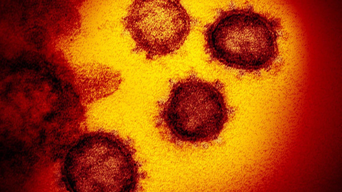Vom neuen Coronavirus SARS-CoV-2 gibt es mittlerweile verschiedene Mutationen. Forscher gehen bislang nicht davon aus, dass der Erreger dadurch gefährlicher oder infektiöser geworden ist.