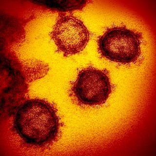 Vom neuen Coronavirus SARS-CoV-2 gibt es mittlerweile verschiedene Mutationen. Forscher gehen bislang nicht davon aus, dass der Erreger dadurch gefährlicher oder infektiöser geworden ist.