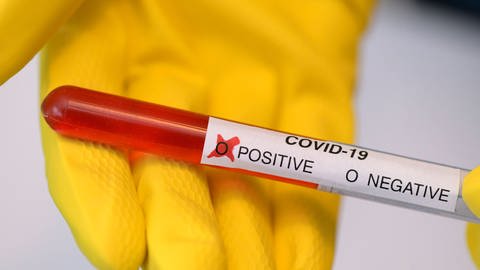 Beim bisherigen standardmäßig verwendeten Test auf das neue Coronavirus wird die Viren-RNA mithilfe eines speziellen Enzyms erst mal vervielfältigt