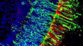 Dünnschnitt eines Retina-Organoiden