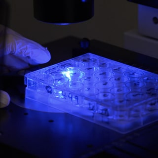Strahlenmediziner untersuchen Knochenmarkszellen am Mikroskop