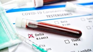 Blutprobe mit Coronavirus Delta-Variante B.1.617.2