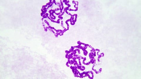 Riesenchromosomen aus der Speicheldruese einer Taufliege