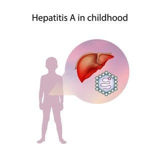In letzter Zeit gab es einige Hepatitis-Fälle bei Kindern. 