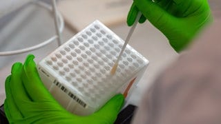 Eine Mitarbeiterin im DKMS Life Science Lab arbeitet an der Einsortierung der medizinischen Wattestäbchen mit Zellen der Wangenschleimhaut für den Typisierungsprozess der DNA.