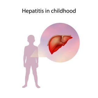 Hepatitis bei Kindern