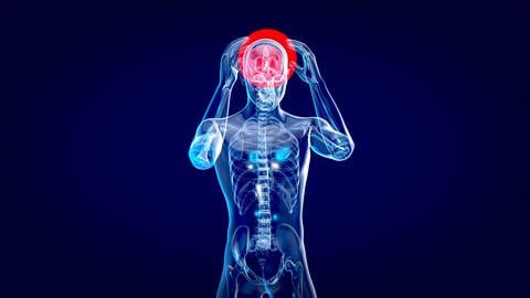 3D Illustration eines menschlichen körpers, bei welchem der Bereich des Gehirns rot gekennzeichnet ist. Der Mensch fasst sich mit beiden Händen an den Kopf.