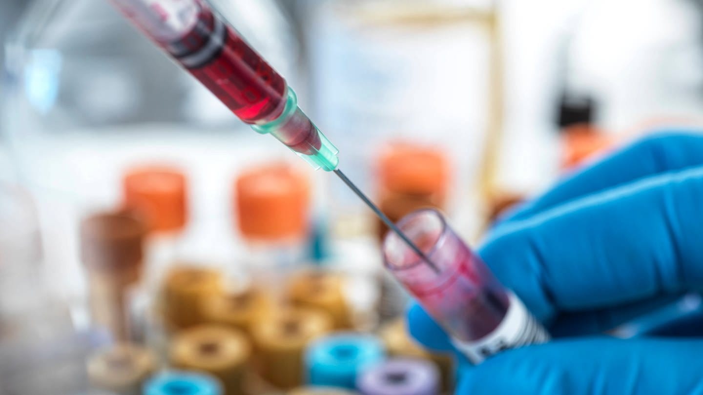 Laborarbeitender füllt eine Blutprobe aus einer Spritze in ein Probenglas.
