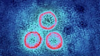 Human Papilloma Viren unter dem Mikroskop