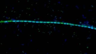 Mikrobe des Jahres - Kabel aus Bakterien - Kette von Candidatus Electronema-Zellen unter dem Epifluoreszenzmikroskop