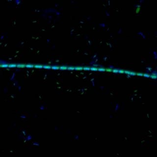 Mikrobe des Jahres - Kabel aus Bakterien - Kette von Candidatus Electronema-Zellen unter dem Epifluoreszenzmikroskop