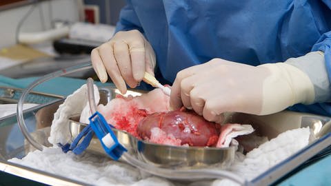 Vorbereitung für Nierentransplantation