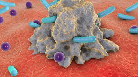 Makrophage mit Bakterien verschiedener Größen
