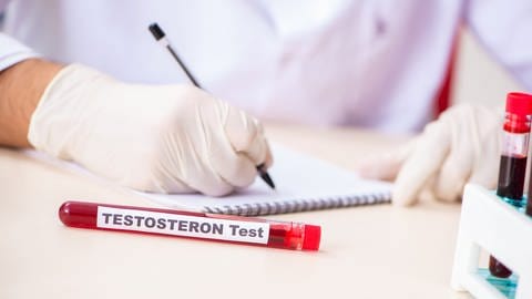 Ist ein Testosteron Test wirklich sinnvoll, um zu entscheiden wer im Sport als Frau antreten darf und wer nicht?