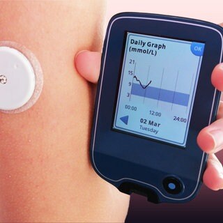 Kontinuierliche Messung des Blutzuckers auch CGM-System genannt. Mit einem Sensor unter der Haut wird kontinuierlich der Blutzucker von Menschen mit Diabetes gemessen. 