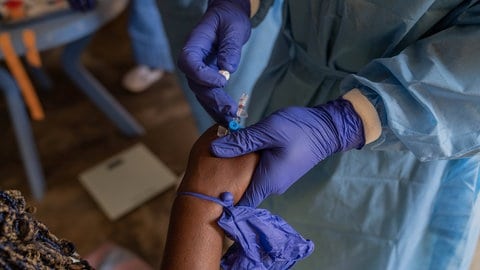 Ein Kind im Kongo bekommt eine Impfung gegen das Mpox-Virus - früher Affenpocken genannt. Diese Krankheit brach erst vor kurzem in großer Fallzahl im Kongo aus und hat ähnliche Ursachen udn Gefahren wie nun die Krankheit X.