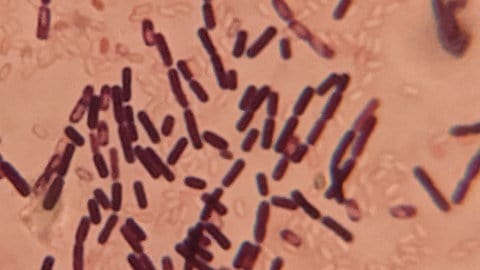 Mikrospisches Bild von Escherichia coli. Unter einem Mikroskop erkennt man die stäbchenförmigen E. coli-Bakterien. Sie sind von besonderer Bedeutung in der Forschung.